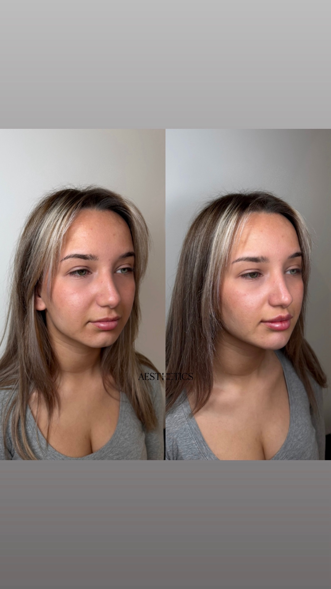 Facial Balancing